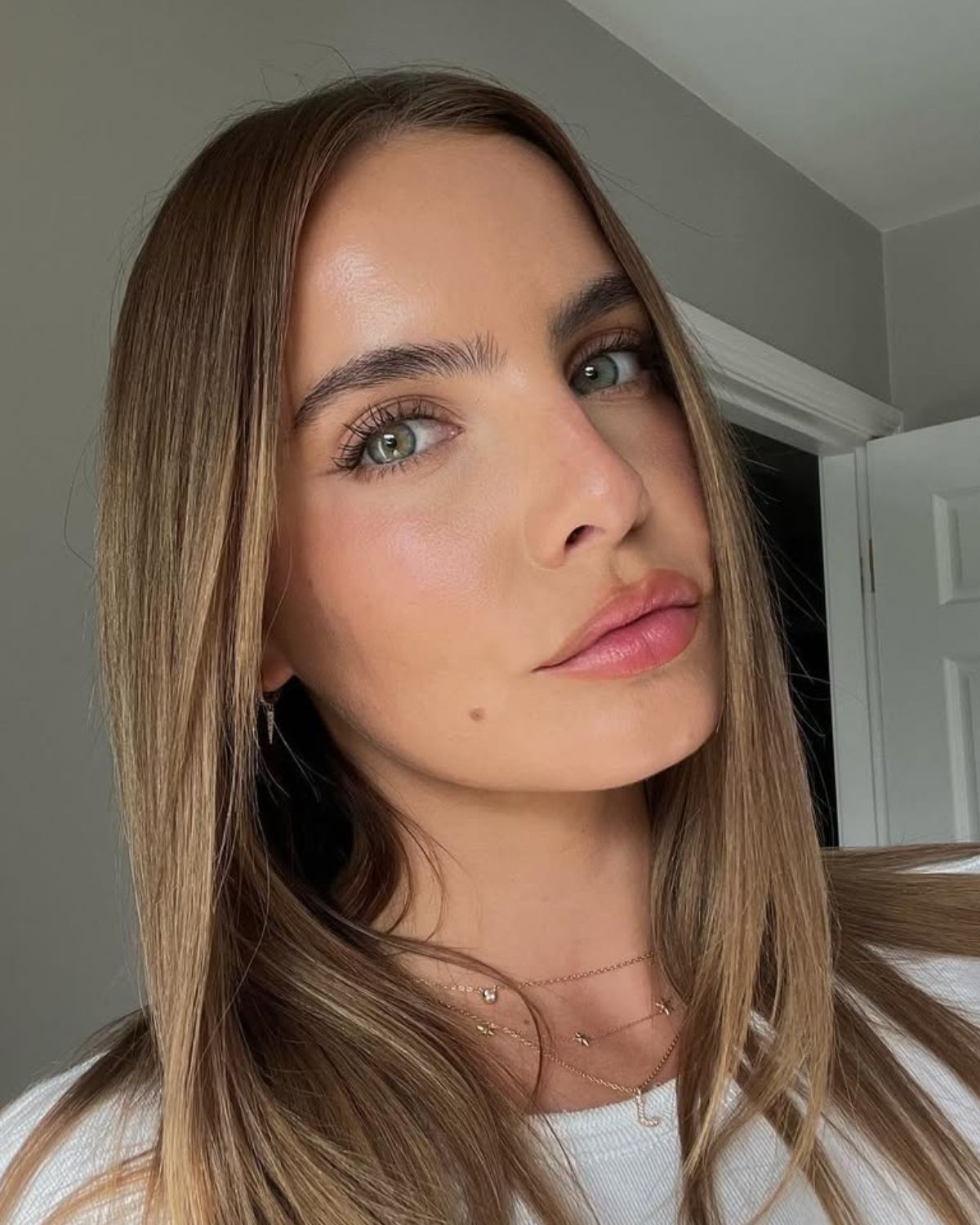 Jak powiększyć usta? Lip lift, lip flip, kwas hialuronowy – przegląd technik