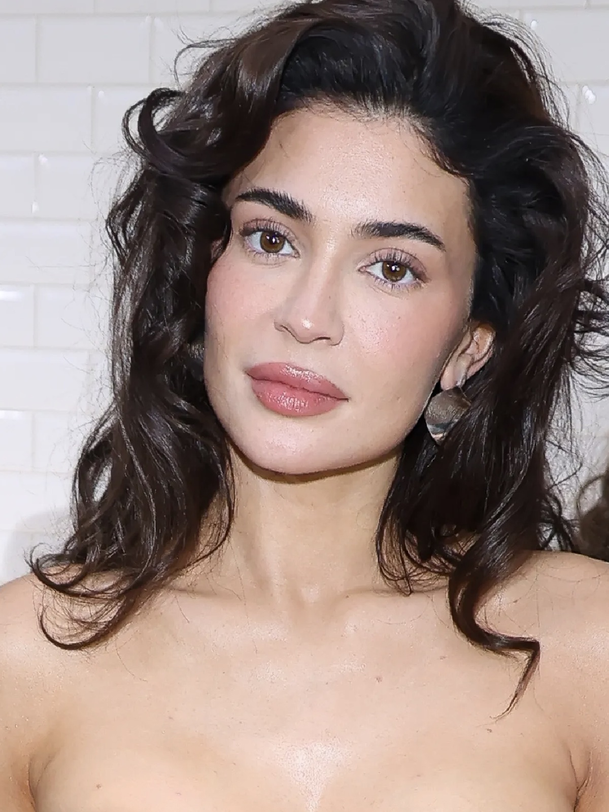 „Filler fatigue”: co to jest i jak uniknąć efektu zmęczonej skóry po wypełniaczach