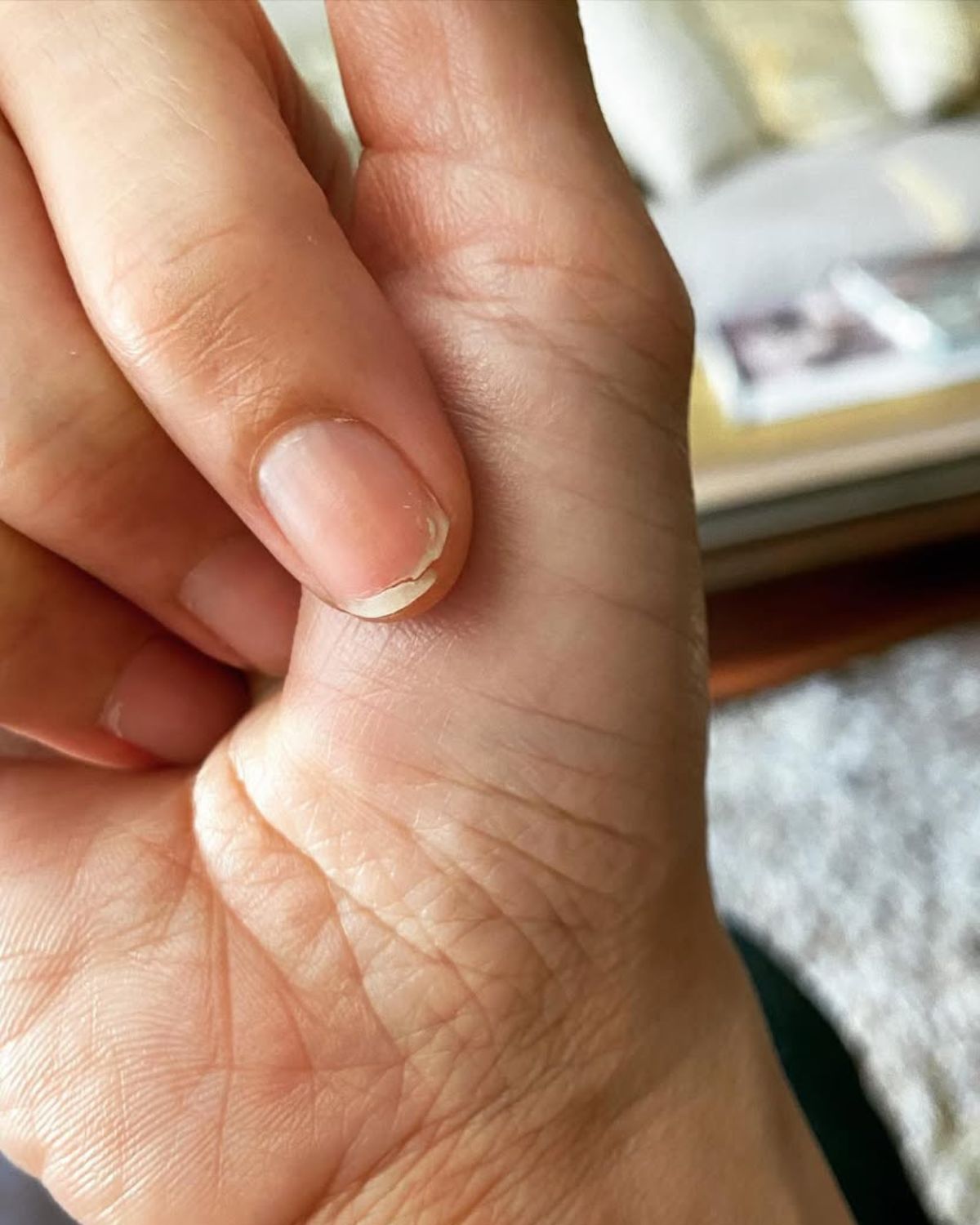 Ozempikowe paznokcie – zdradzają, czy odchudzałaś się kontrowersyjnym lekiem