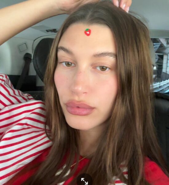Hailey Bieber botoks. Hailey Bieber w selfie z samochodu w paski, z małą naklejką truskawki na czole. Jej cera jest naturalna, bez makijażu i widocznie nawilżona, co podkreśla lekki rumieniec na policzkach i nosie. Wygląd jest autentyczny i świeży, potwierdzając jej podejście do naturalnego piękna, bez ukrywania drobnych niedoskonałości.