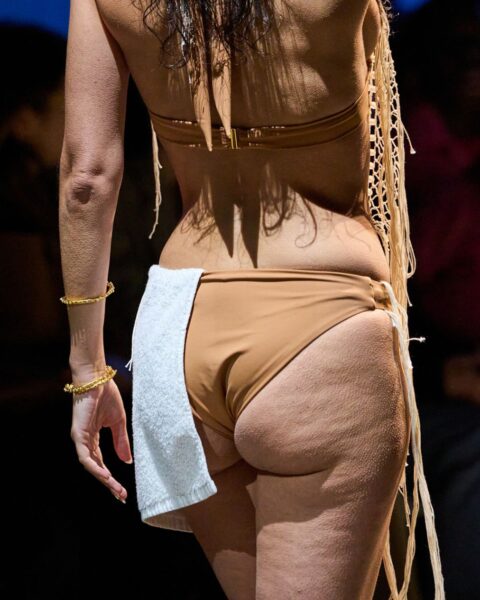 Ozempikowe pośladki – czym są? Efekt uboczny jako cena ekspresowego chudnięcia z&nbsp;lekami