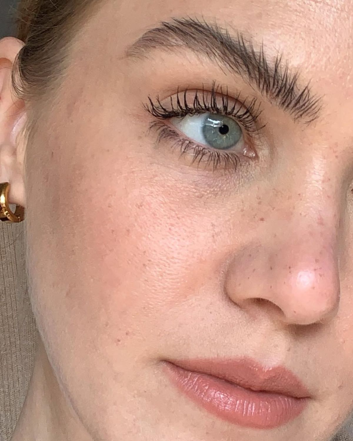 Zamiast efektu wow – zmęczenie i ból głowy. Botoksowa grypa to efekt uboczny, o którym mało kto mówi